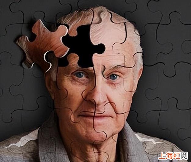 大脑萎缩吃什么药效果好 老年人脑萎缩吃什么药能控制