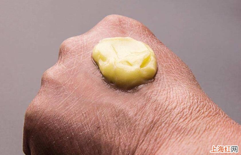 手裂怎么办
